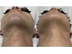 アールビューティー(R Beauty)の写真