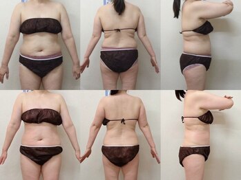 スマイルデイズ(Smiledays)/たった月に一回の施術のみ