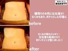 ソレイユビューティー 愛知大学前(SOLEIL BEAUTY)/お腹のリンパマッサージ