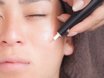 エムズハグ(M's hug)の写真/低温の低周波パルスでシミ部分にプローチします！