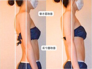 ピュアノア 垂水店/痩身人気No.2【骨格・姿勢矯正】