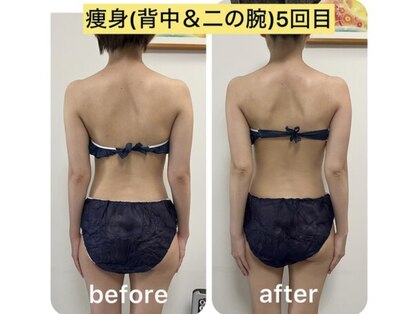 アーチ(AR-CH.)の写真