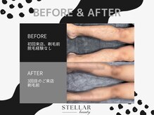 ステラー(STELLAR)