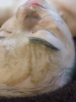 グリッター(GLITTER)/透白肌ピーリング