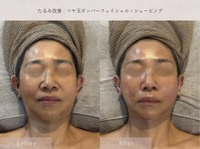 スイ(Sui)の雰囲気（ふっくらハリ感で引き締まったお肌に）