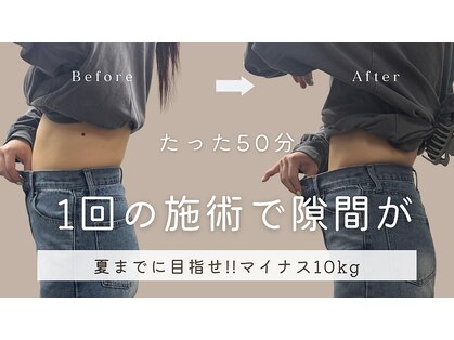 強力痩身専門店　西麻布【La.SALON HOPE】の写真