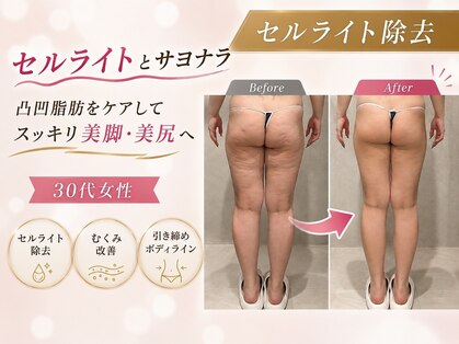 【大人女性の痩身・むくみ改善】EARNEST甲子園口の写真