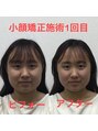 オズ六本木&nbsp;小顔矯正/小顔マッサージ/小顔調整/小顔/矯正/コルギ/ヘッドスパ