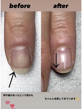 ココ(COCO)/長年の癖って分かりますか?