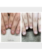 サロン エース(salon ace)/お悩み解決！