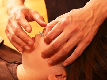 くるみハウス/美容鍼