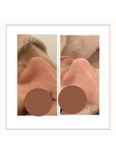 ディアー(Dear)/陶肌トリートメント