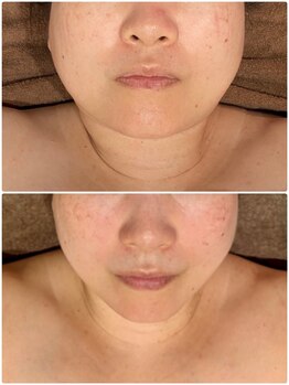 ディアウーマン(Dear Woman)/【スリミラフェイシャル】