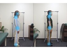 整骨院こころ 祇園院/ビフォーアフター