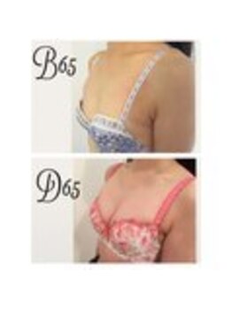 美人バスト 表参道店/【バストアップ/育乳 症例】