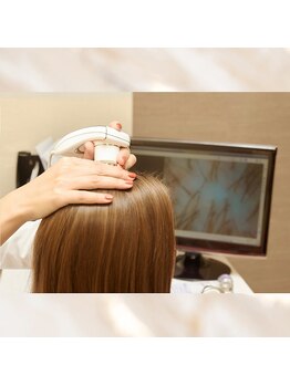 ユメスパ 銀座(YUMESPA)/スコープで頭皮の状態をチェック