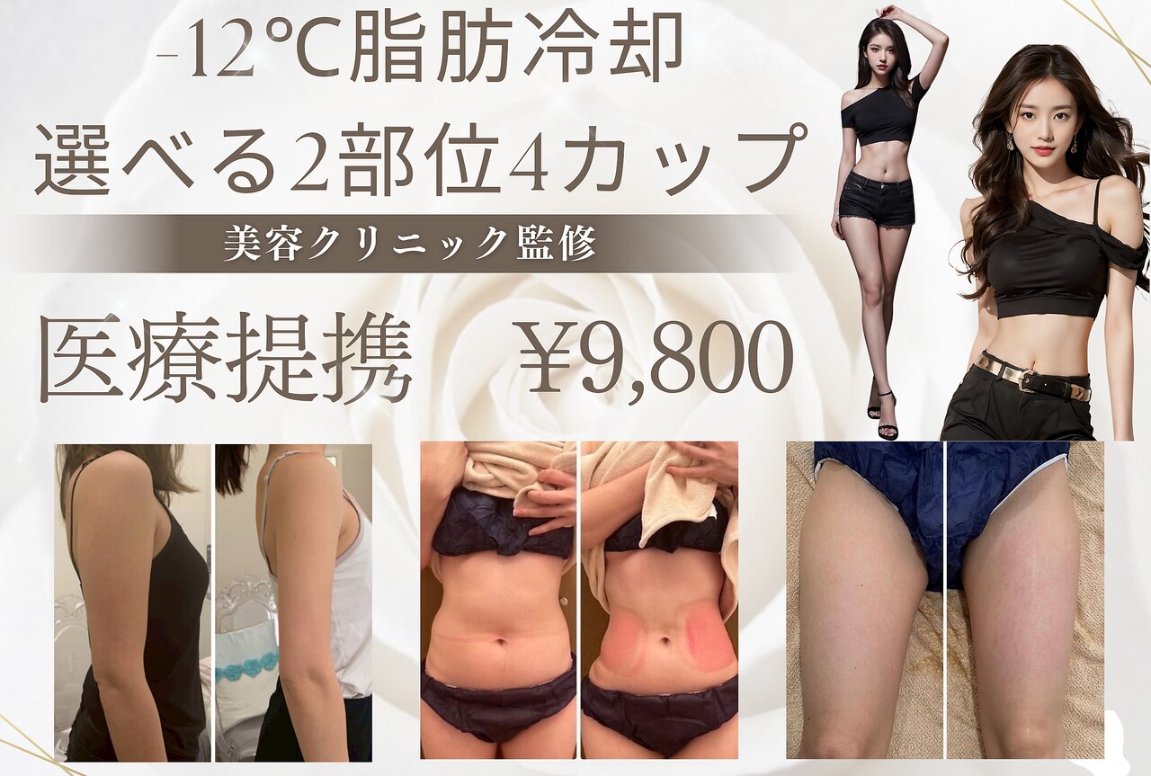 【医療提携痩身人気No.1】-12℃脂肪冷却×《選べる2部位/4カップ》￥9,800