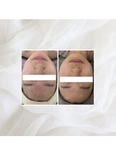 プリマプリート 名駅店/VOSサロンケア