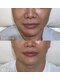 ウーナ(Una)の写真/歯科衛生士による「口元から整える」小顔ケア