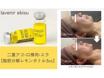 ラブニール 恵比寿店の写真/最新♪韓国式脂肪分解剤[レモンボトル]登場!理想の小顔・フェイスラインへ◎レモンボトルベーシック￥8000