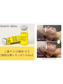 小顔になりたい