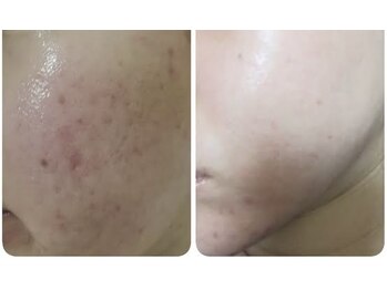 スリリアン 銀座/★お客さまビフォーアフター★