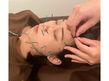 健康堂 荏原町院/美容鍼もお任せください♪