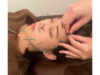 健康堂 荏原町院/美容鍼もお任せください♪