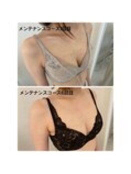 美人バスト 表参道店/【バストアップ/育乳 症例】