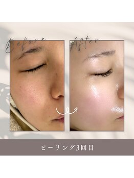 セレニティ バイ マリ(Serenity by Mari)/