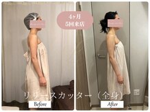 リノ(Lino)/肩こり改善で4ヶ月ご来店♪