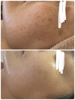 サロンニーナ(Salon.Nina)/韓国肌管理セルマン