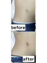 リフト 京都河原町(Lift)&nbsp;夏前！お腹 美くびれ