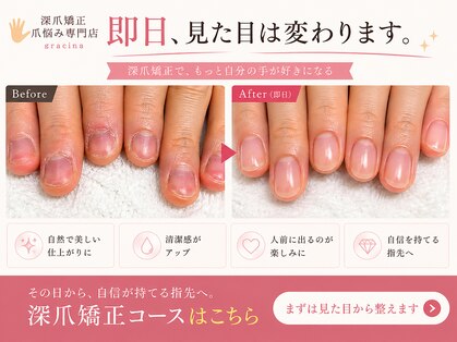 グラシナ 鳥丸店の写真