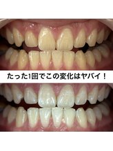 ヤット 森ノ宮(yatto.)/たった1回でここまで変わるとは