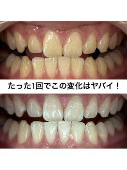 ヤット 森ノ宮(yatto.)/たった1回でここまで変わるとは