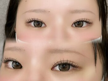 ミライ トータルビューティーサロン(mirai)の写真/夏の紫外線ダメージ、秋花粉の季節こそ目元ケアを★