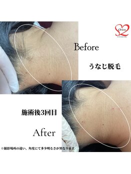 オリオンドットエスツー(Orion.S2)/【Before→After】