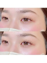 アイランド トーキョー(ISLAND TOKYO)/上下ラッシュリフト