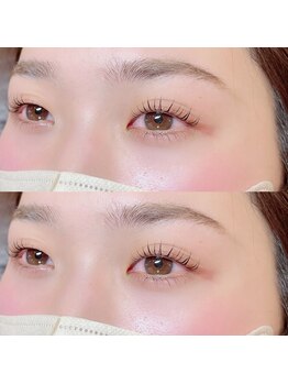 アイランド トーキョー(ISLAND TOKYO)/上下ラッシュリフト