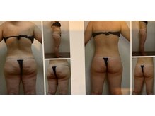 クレビア 神保町 水道橋(CREBIA)/ダイエット/痩身サロン