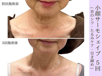 ラエッセ(La Esse)/60代以降でも諦めないで