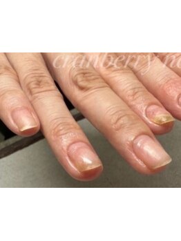 爪の悩みを解消できる（ケア含む）