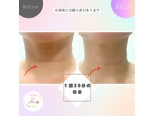 サロン ミー(salon Mee)の雰囲気（【コラーゲンマシン30分でシワ改善】）