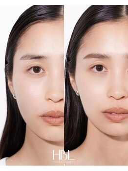 リュクス(Luxe+TKM HANATEN)/HBL ハリウッドブロウリフト