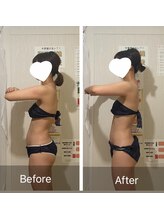 ウツク(utuku)/筋膜リリース　姿勢歪みコリ改善