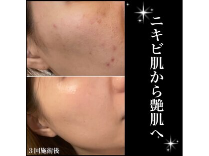 モンクラッシー(Mon classy)の写真