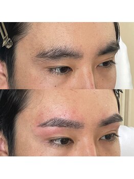 ビオプラス(BIO PLUS)/