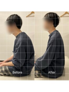 ナオル整体 池袋院(NAORU整体)/猫背矯正の施術前後【池袋整体】