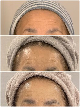 ブリノス(BLINOSS)/オーダーメイドフェイシャル